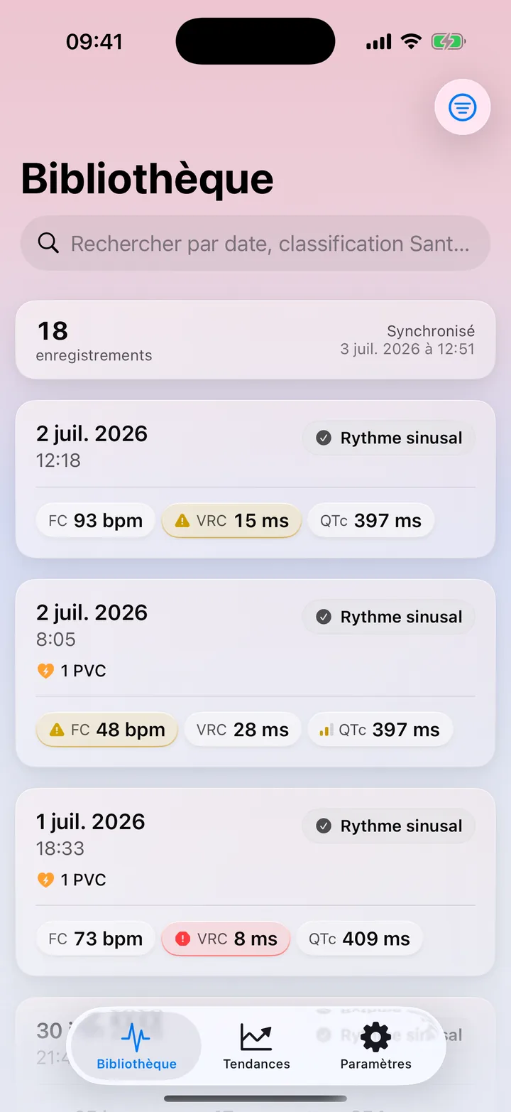 La bibliothèque d'ECG Tracker+ répertoriant les enregistrements ECG de l'Apple Watch avec leur classification du rythme et leurs mesures clés