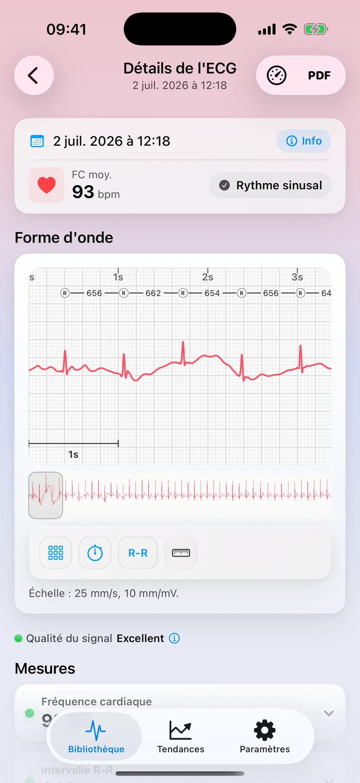 L'écran Mesures d'ECG Tracker+ avec une Qualité du signal Excellente, la fréquence cardiaque, l'intervalle R-R, la HRV, la durée et l'amplitude du QRS, chacun accompagné d'une pastille d'état