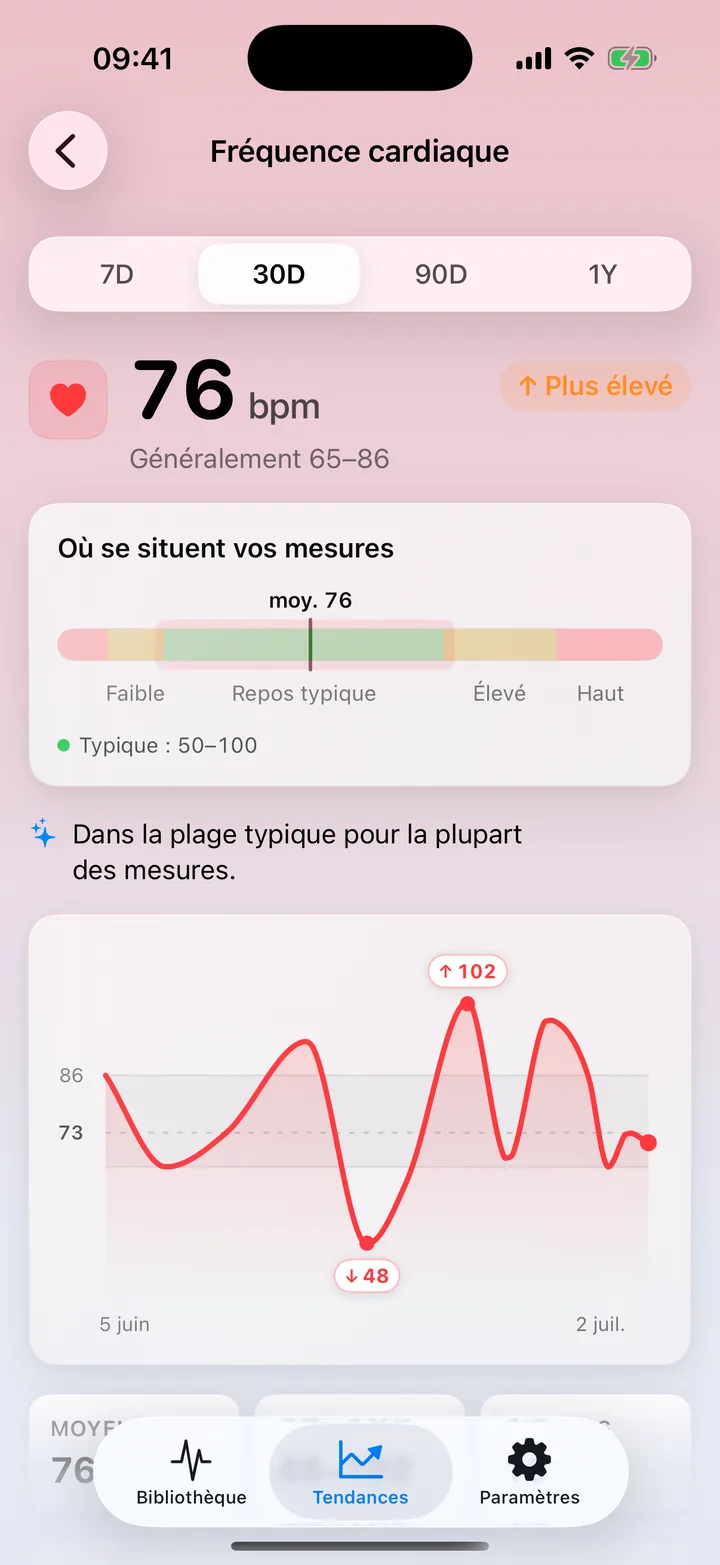 Le détail de la fréquence cardiaque dans les Tendances d'ECG Tracker+ : une moyenne sur 30 jours de 76 bpm dans la plage habituelle, une barre de distribution et un graphique en courbe des relevés quotidiens, avec les points hauts et bas indiqués