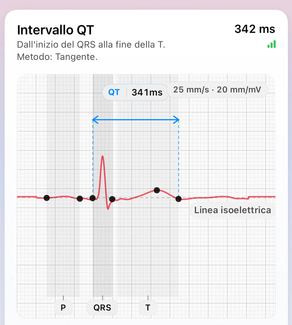 La schermata Morfologia del battito di ECG Tracker+: un battito rappresentativo costruito dai battiti più stabili, con i marcatori di riferimento P, QRS e T, la linea isoelettrica e un intervallo QT di 341 ms misurato con il metodo della tangente (dall'inizio del QRS alla fine dell'onda T)