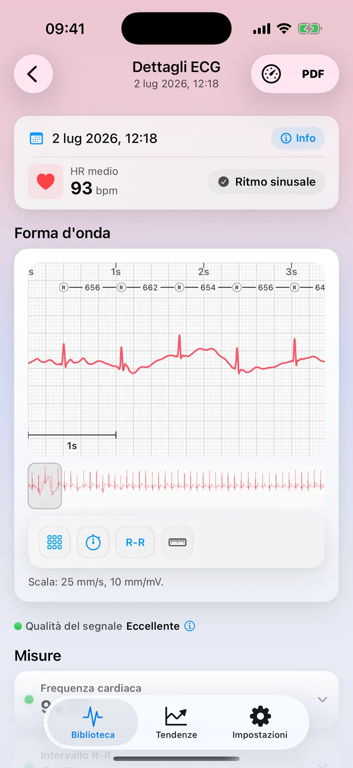 La schermata Misurazioni di ECG Tracker+ con Qualità del segnale Eccellente, frequenza cardiaca, intervallo R-R, HRV, durata e ampiezza del QRS, ognuno con un indicatore di stato