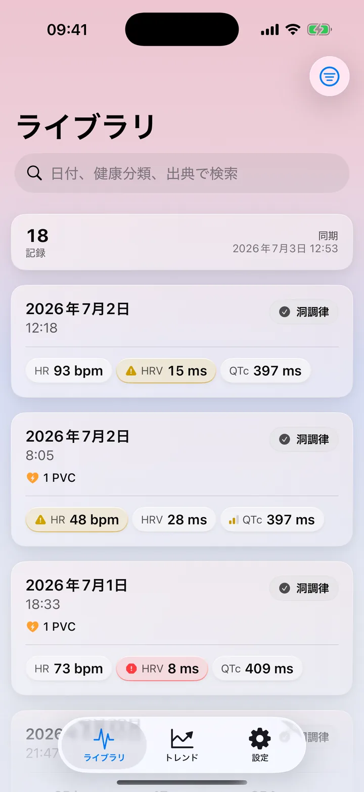 ECG Tracker+のライブラリ。Apple&nbsp;Watchの心電図の記録を、リズム分類と主要な測定値とともに一覧表示