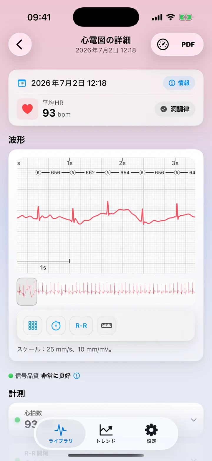 ECG Tracker+の測定値画面。信号品質「非常に良好」、心拍数、R-R間隔、HRV、QRSの幅と振幅を、それぞれステータスドット付きで表示