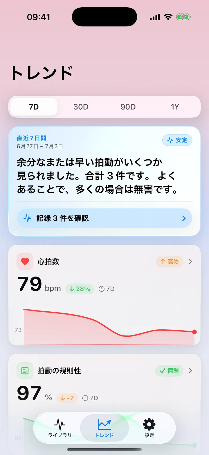 ECG Tracker+の傾向の概要画面。直近7日間の振り返りでいくつかの気になる拍動に触れ、心拍数と拍動の規則性の傾向カードとそのグラフを表示