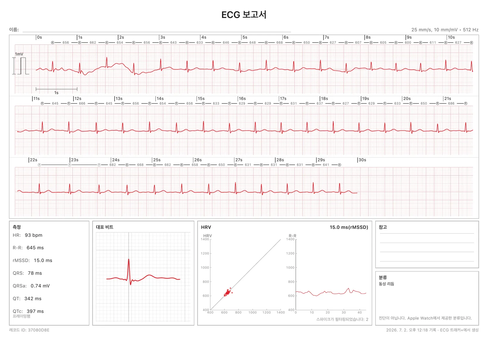 인쇄용으로 준비된 ECG Tracker+ PDF 리포트: R-R 표시가 있는 30초 보정 심전도 스트립과 측정값, 대표 박동, HRV 그래프, 리듬 분류