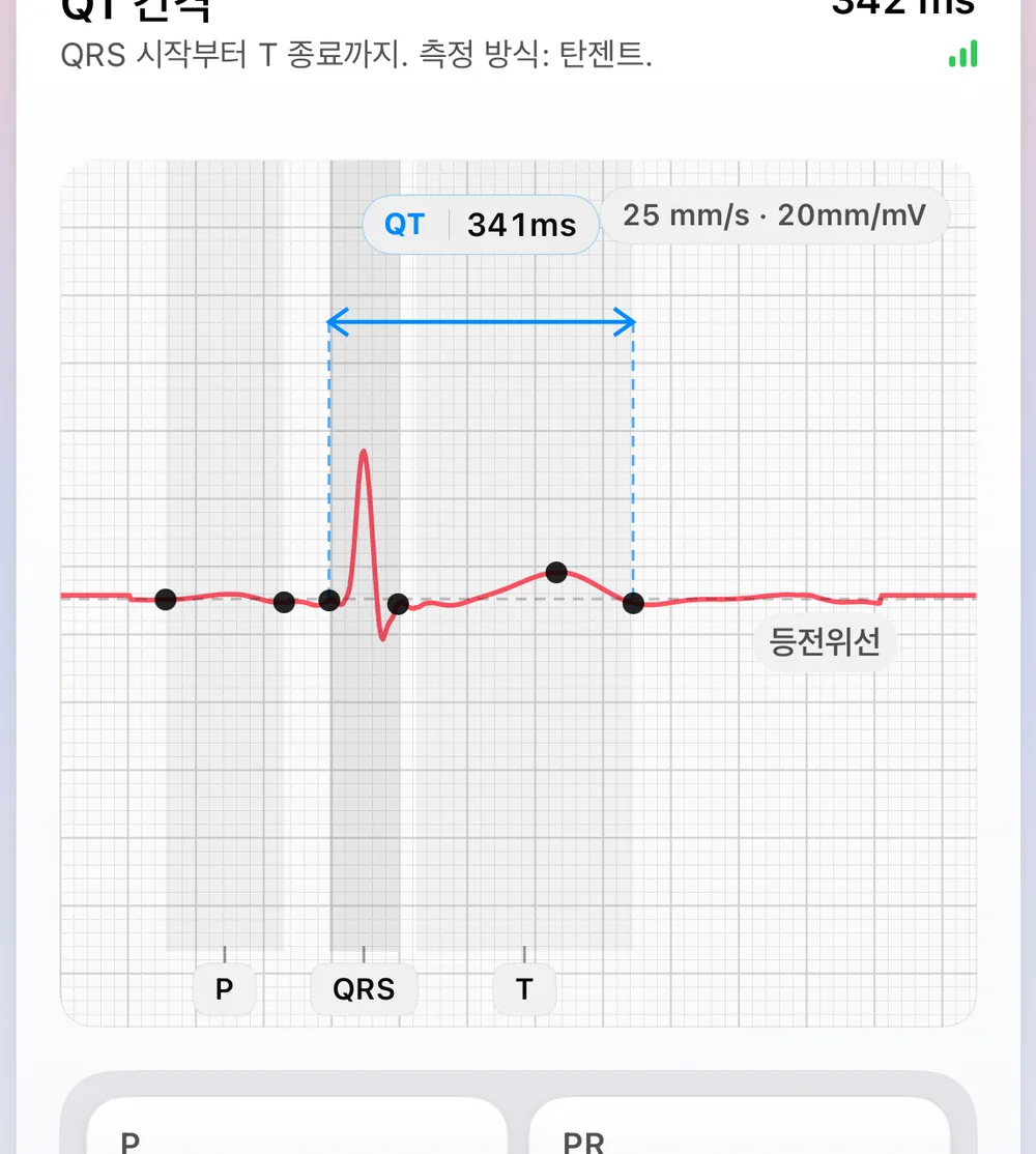 ECG Tracker+ 박동 형태 화면: 가장 안정적인 박동들로 만든 대표 박동에 P, QRS, T 기준점과 등전위선이 표시되고, 접선법(QRS 시작점에서 T 종료점까지)으로 측정한 QT 간격 341 ms가 함께 나옵니다
