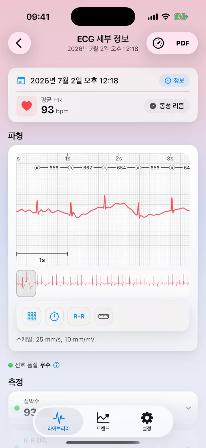 신호 품질 매우 좋음, 심박수, R-R 간격, HRV, QRS 지속시간과 진폭이 각각 상태 표시점과 함께 나오는 ECG Tracker+ 측정 화면