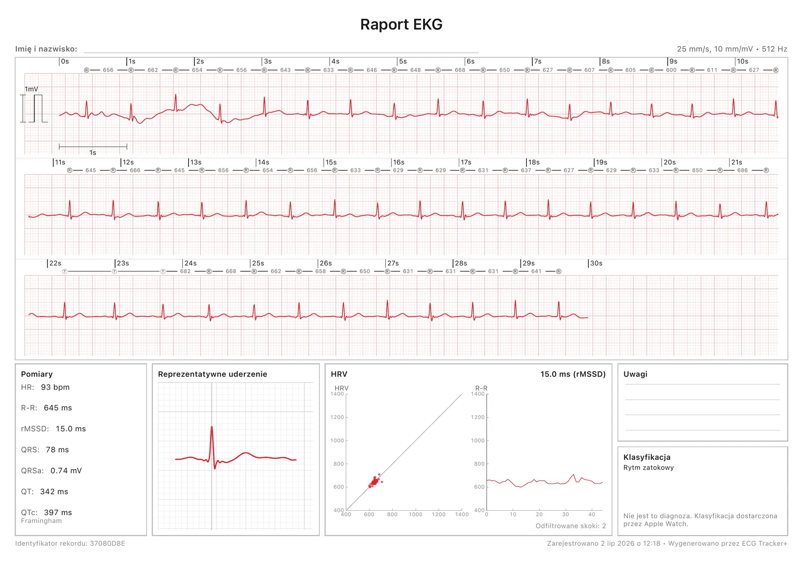 Gotowy do druku raport PDF z ECG Tracker+: 30-sekundowy wykalibrowany pasek EKG ze znacznikami R-R, a do tego pomiary, reprezentatywne uderzenie serca, wykres HRV i klasyfikacja rytmu
