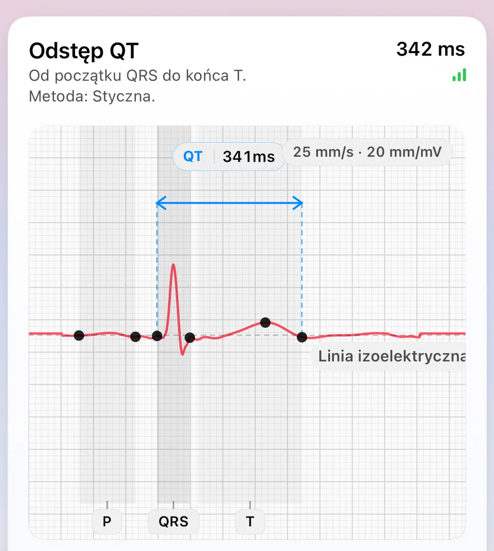 Ekran Morfologia pobudzeń w ECG Tracker+: reprezentatywne uderzenie serca złożone z najbardziej stabilnych pobudzeń, ze znacznikami charakterystycznymi P, QRS i T, linią izoelektryczną oraz odstępem QT 341 ms zmierzonym metodą stycznej (od początku QRS do końca załamka T)