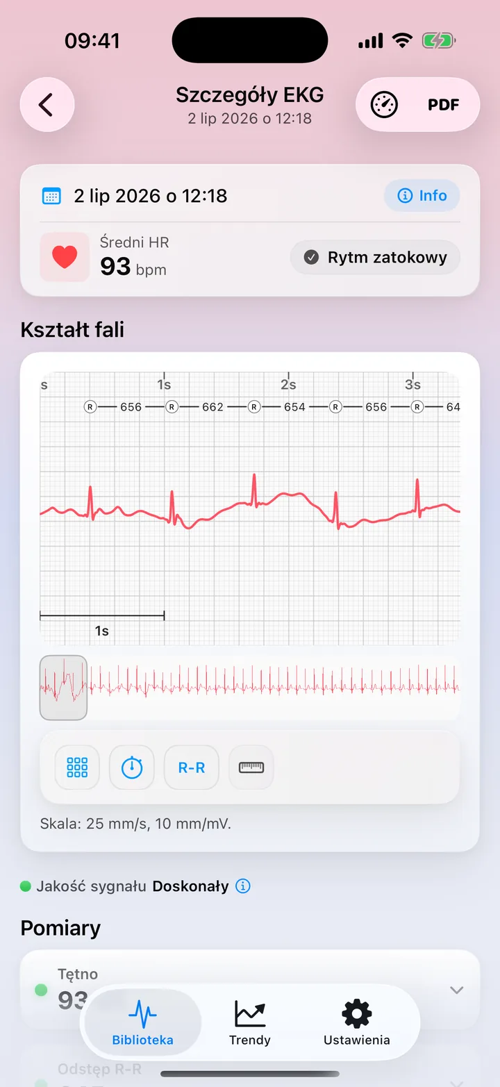 Ekran Pomiary w ECG Tracker+ z Jakością sygnału Doskonała, tętnem, odstępem R-R, HRV, czasem trwania i amplitudą QRS, każde z kropką stanu