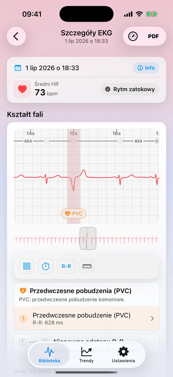 Widok szczegółowy w ECG Tracker+ z oznaczeniem możliwego wzorca PVC na przebiegu