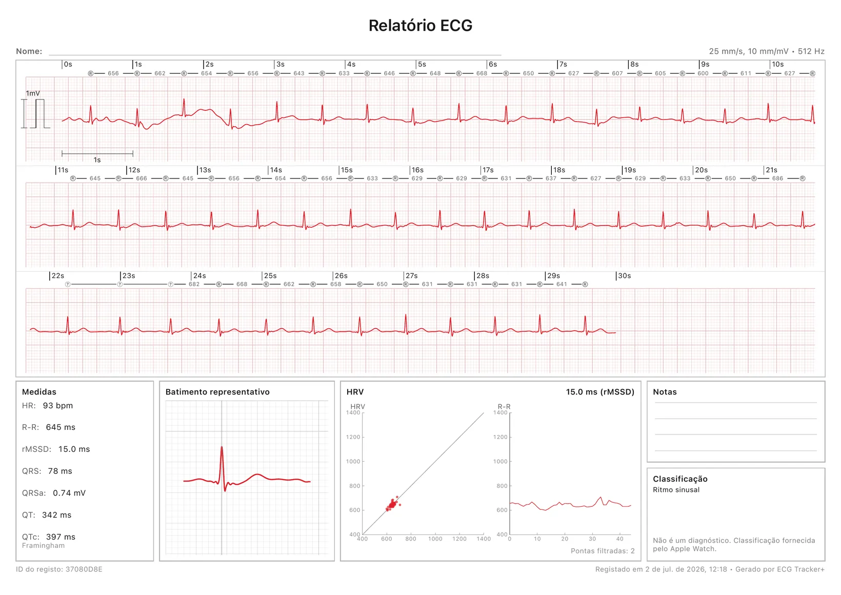 Um relatório em PDF do ECG Tracker+ pronto para impressão: uma tira de ECG calibrada de 30 segundos com marcadores R-R, além de medições, um batimento representativo, um gráfico de HRV e a classificação do ritmo