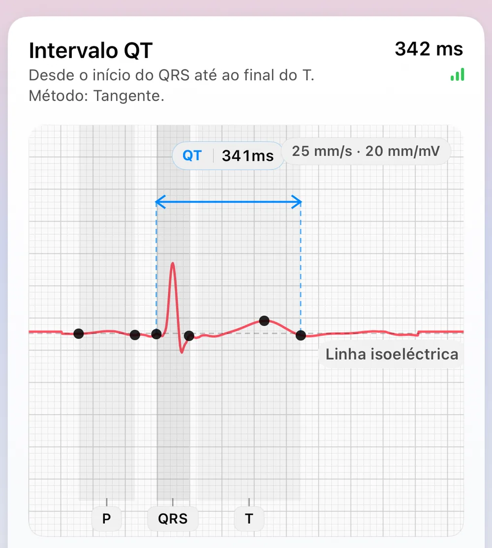 Tela de Morfologia do Batimento do ECG Tracker+: um batimento representativo construído a partir dos batimentos mais estáveis, com marcadores fiduciais P, QRS e T, a linha isoelétrica e um intervalo QT de 341 ms medido pelo método da tangente (do início do QRS ao fim da onda T)