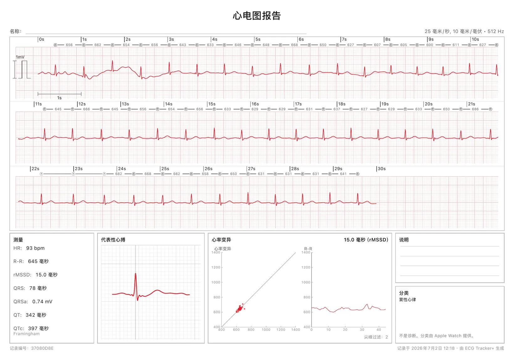 一份可直接打印的 ECG Tracker+ PDF 报告：30 秒校准心电图条带，带 R-R 标记，另有各项测量、一次代表性心搏、HRV 图表与节律分类。