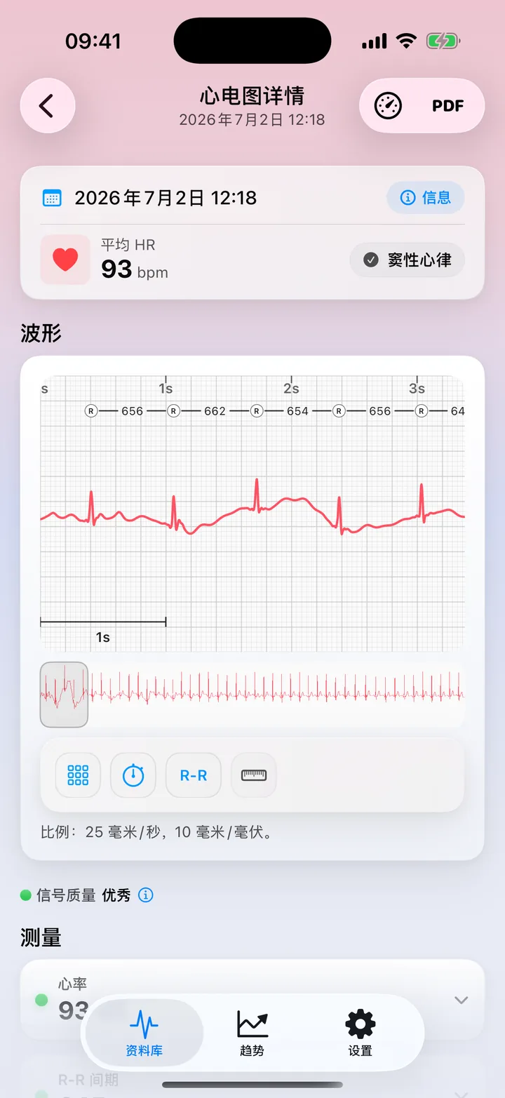 ECG Tracker+ 测量界面，信号质量为「极佳」，显示心率、R-R 间期、HRV、QRS 时限与振幅，每项各有一个状态圆点。